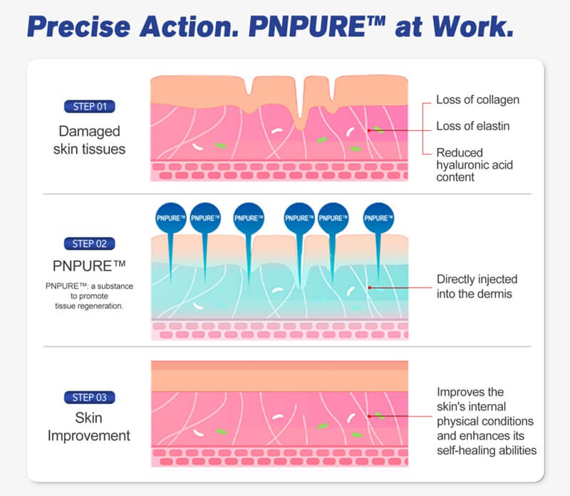 polynucleotide injection products