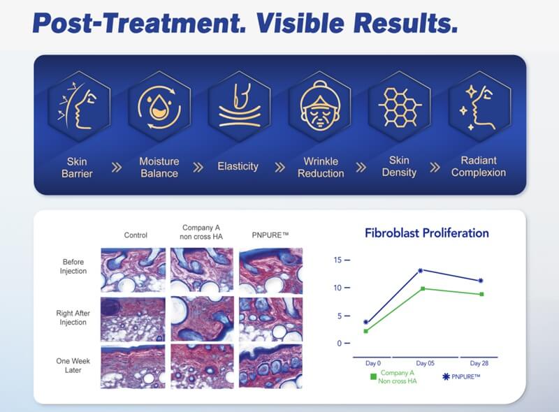 how pnpure pn filler works