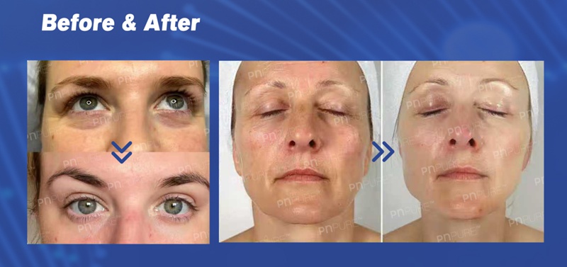 polynucleotide injection products