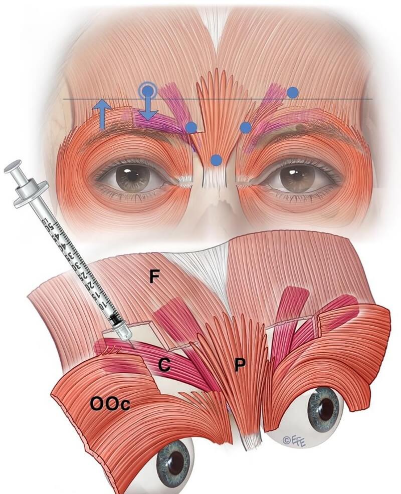 Improved lateral corrugator targeting
