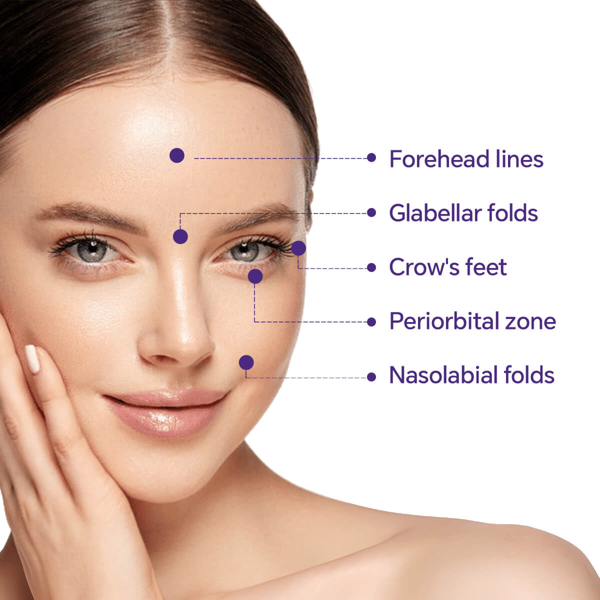 innotox 50 units botulinum toxin application areas