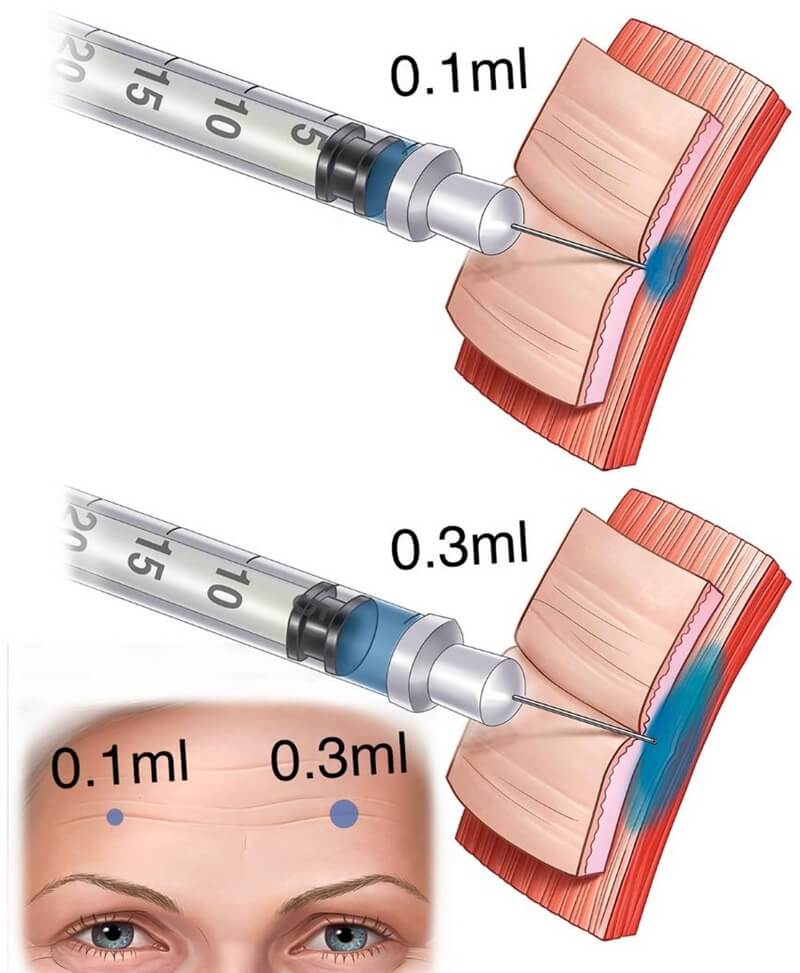 Injection dilution vs. diffusion range