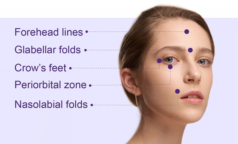 Sotorior Toxin Treatment