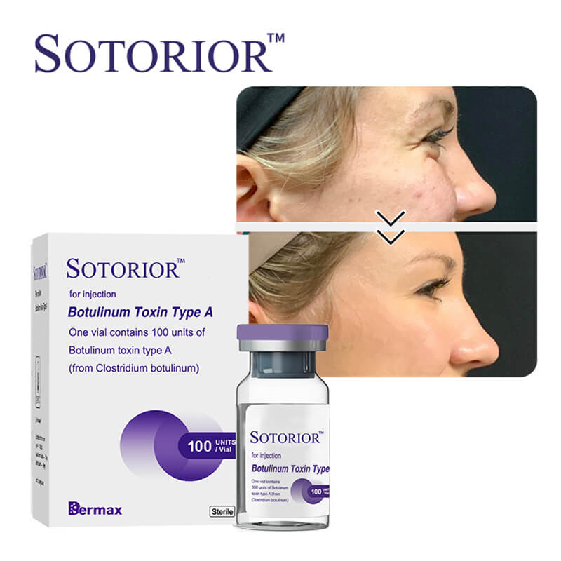 buy botulinum toxin cost wholesale price