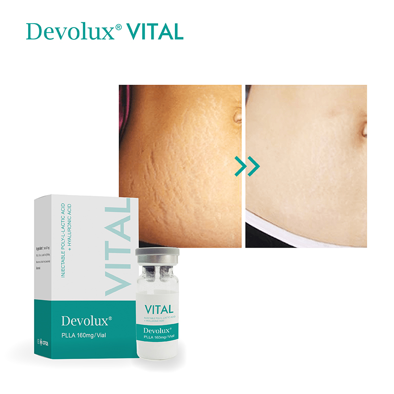 Devolux® Vital PLLA Dermal Filler Injection