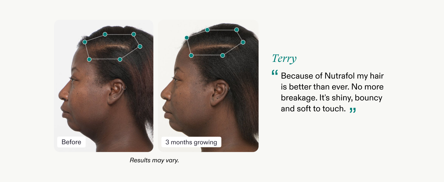 terry before and after