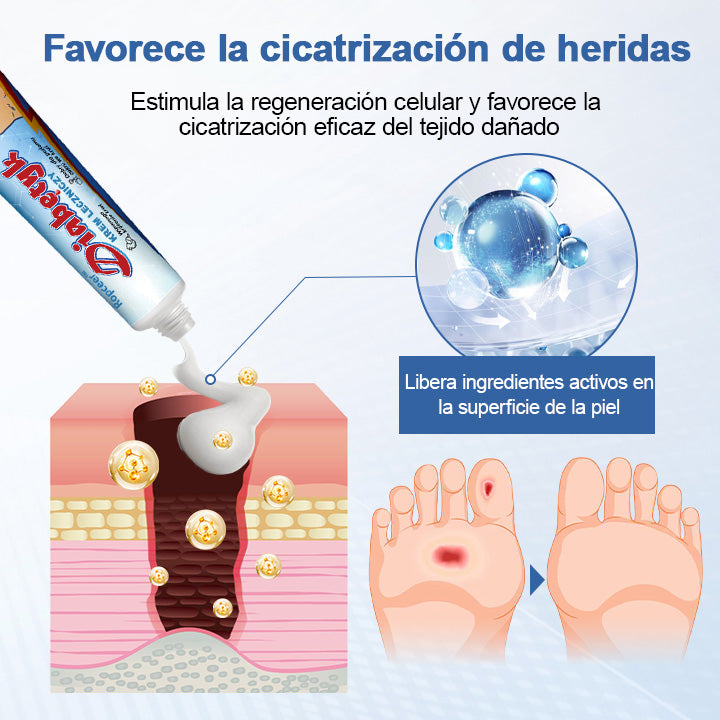 𝐑𝐨𝐩𝐜𝐞𝐞𝐫™ Crema Terapéutica para Diabetes🇲🇽Federación Mexicana de Diabetes (FMD)👩‍🔬
