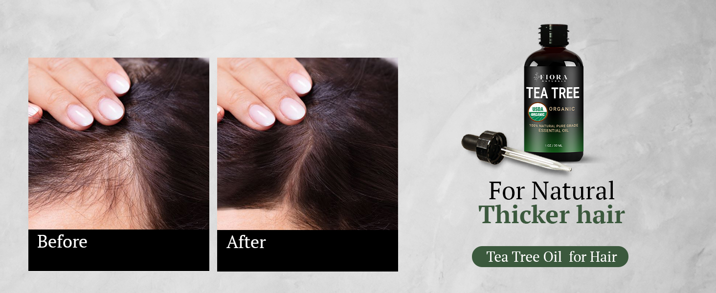 Tea Tree Oil for hair