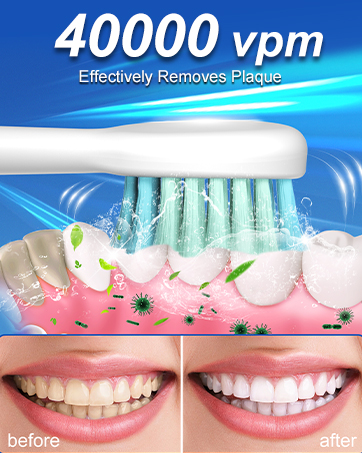 Electric Toothbrush