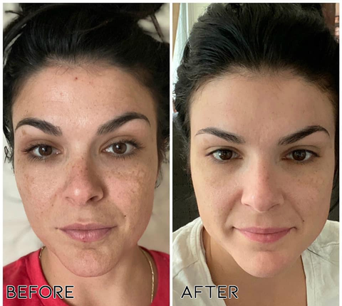 JEREMYTIS™ Herbal Spots Peel-Off Facial Mask