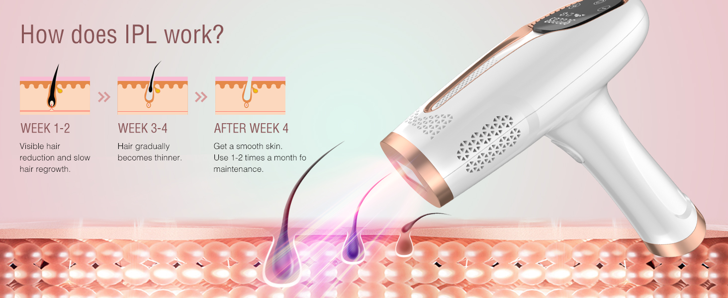 laser hair removal