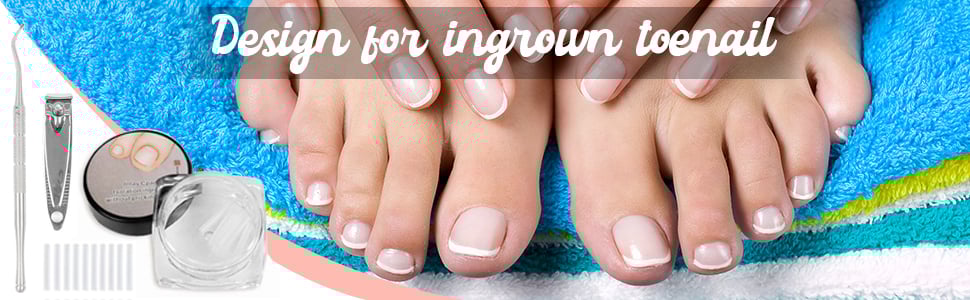 Ingrown Toenail Corrector Strips