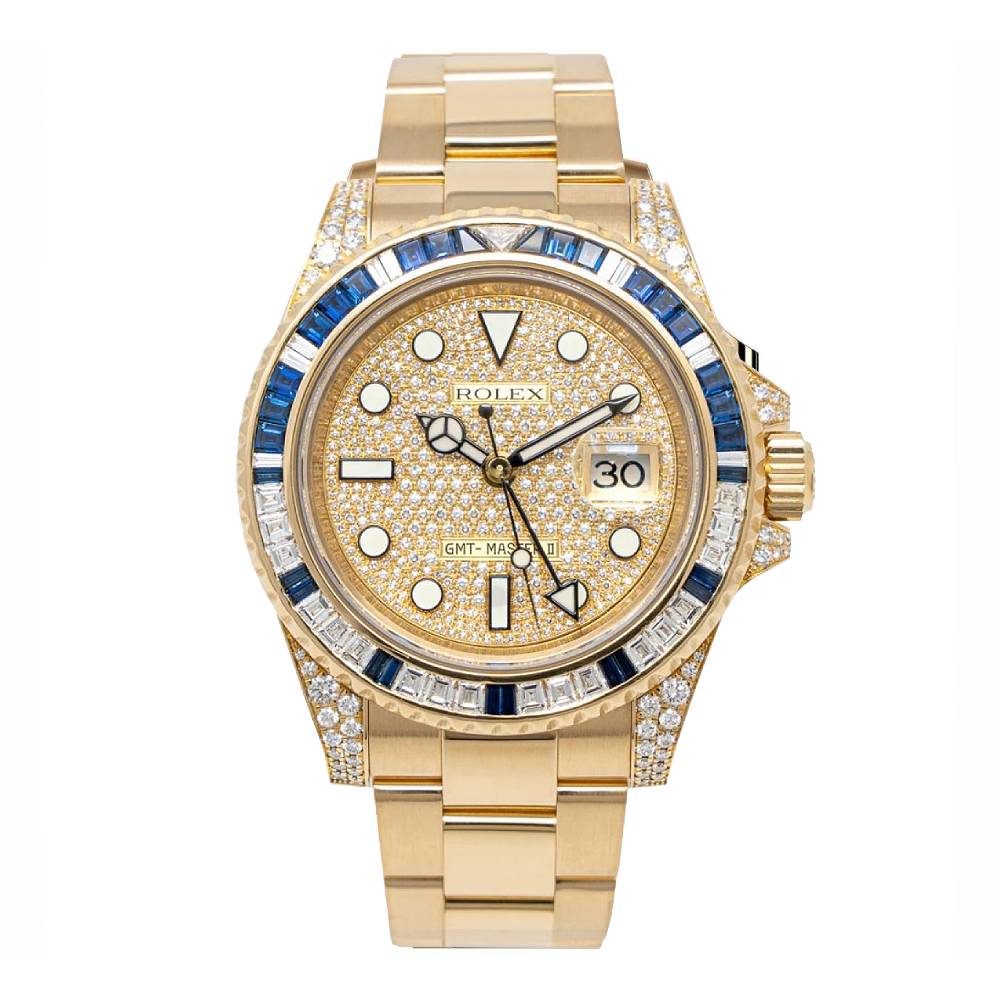 ZIICK Watch 1