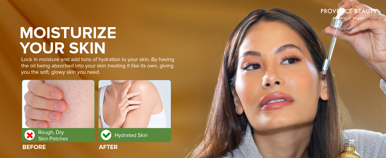 Moisturize your skin